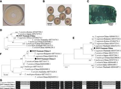 Case Report: Molecular Diagnosis Revealing an Intestinal Infection of a Hybridized Tapeworm (Taenia saginata and Taenia asiatica) to Human in Yunnan, China